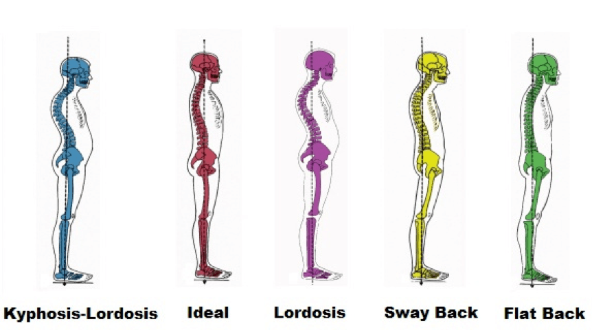 Posture and Dance - Portside Physiotherapy
